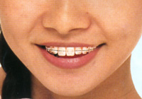 uPbg02